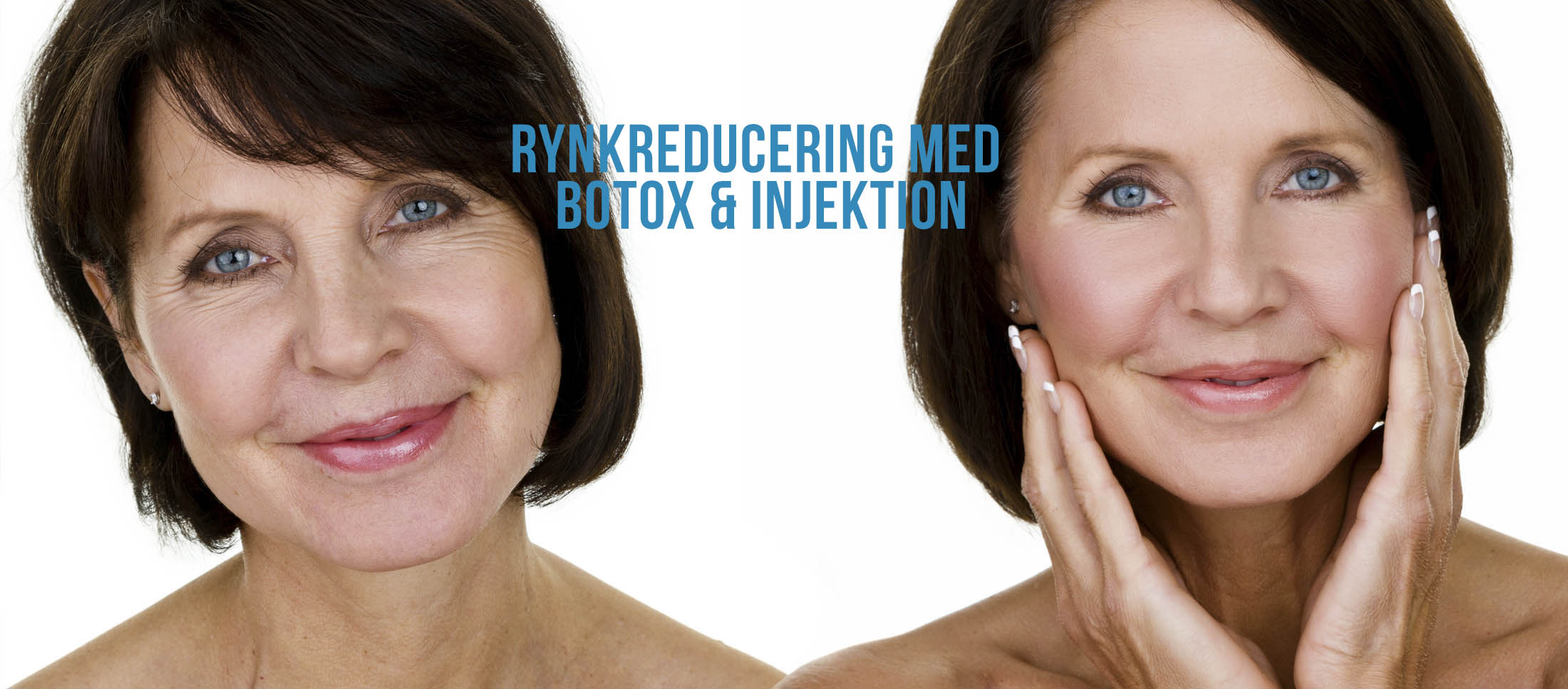 rynkreducering med injektion